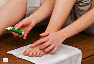 aplikácia masti na liečbu plesní nechtov na nohách